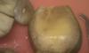 post-37809-0-05524300-1331734871_thumb.j
