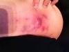 post-58459-0-42453700-1332368818_thumb.j
