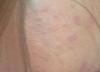 post-37809-0-72186800-1336062042_thumb.j
