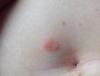 post-82708-1068055_thumb.jpg