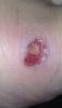 post-76996-187144_thumb.jpg