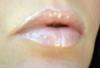 post-22490-1216069966_thumb.jpg