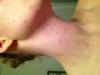 post-37809-0-02679900-1341967896_thumb.j