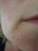 post-37809-0-43161600-1435852748_thumb.j
