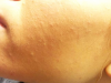 post-56469-0-18643700-1437927084_thumb.p