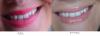 post-58107-0-11442700-1345565825_thumb.j