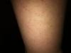 post-37809-0-52177700-1319558934_thumb.j