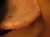 post-31782-1257352945_thumb.jpg