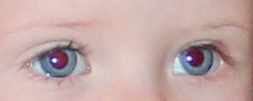 Et hvitt og et rødt øye ved blits hos jente, 2 år - Kropp og helse -  Kvinneguiden Forum