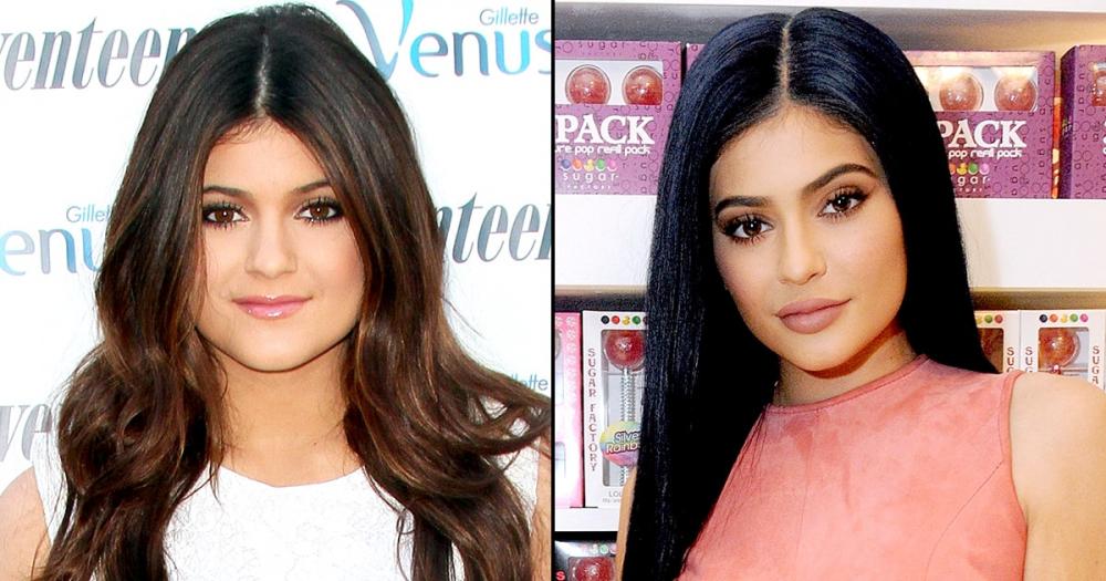 kylie-then-and-now-zoom-106973c5-0204-4e7a-b63d-cfd09fb7b5ba.thumb.jpg.5655fda2774028cc045f41899dd116bf.jpg