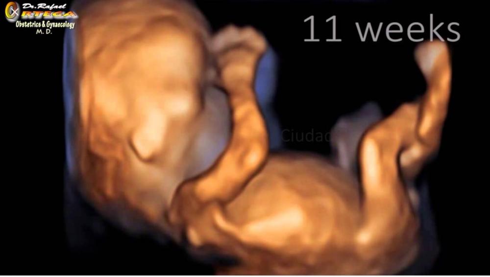 IMG_0431.thumb.PNG.17460bba148c78ff3583706032bc3baf.PNG