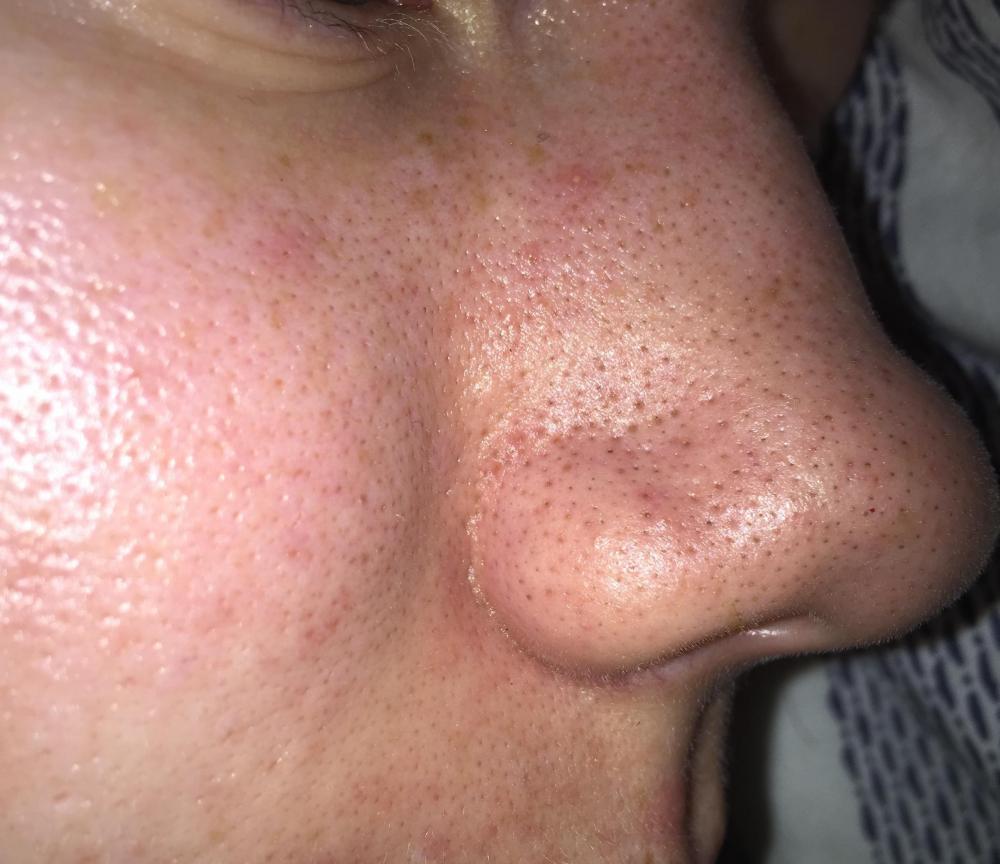 c0e74156da8423dd20252d1b67cc8073.thumb.jpg.4274ffe97a558c80f32d6df1695afbbb.jpg