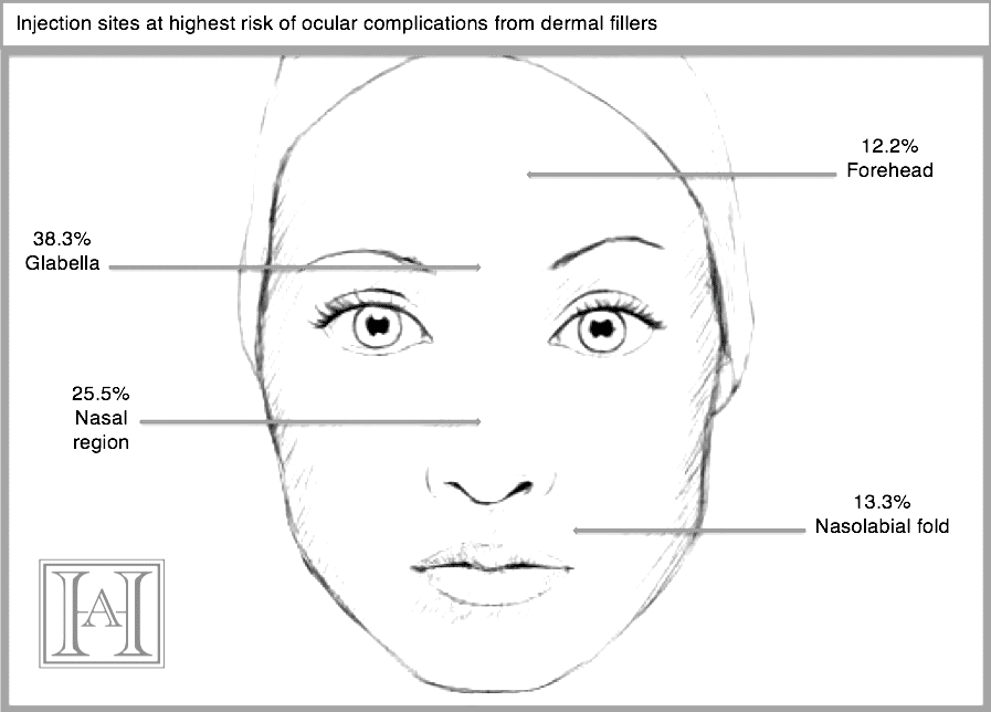 image.png.619f006276797ca9e2956d8a2c4bd041.png