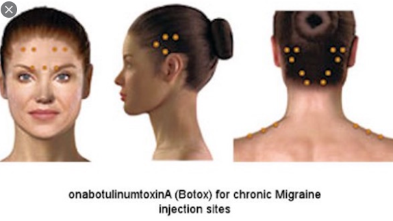 image.png.0dcb2a6cc6f225aec6be2c0e7237be20.png