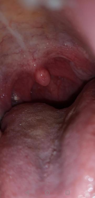 Screenshot_20201021_232245_com.android.gallery3d.jpg