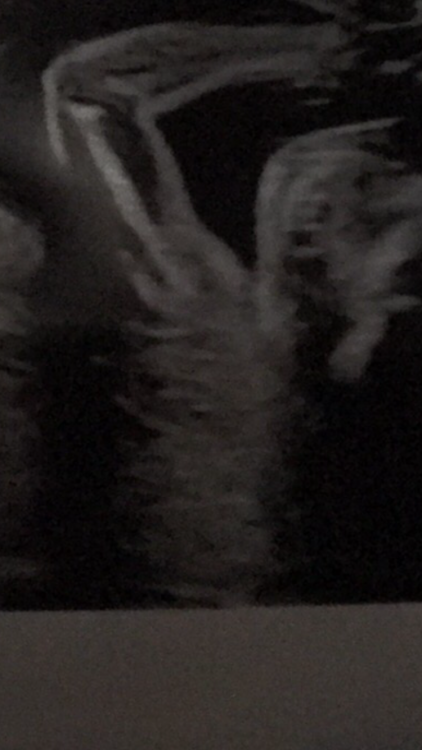 91BB5BF1-AECB-4B0B-9F6F-EEF544661430.png