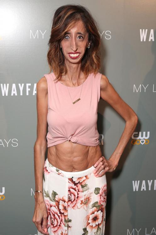 lizzie-velasquez1.jpg