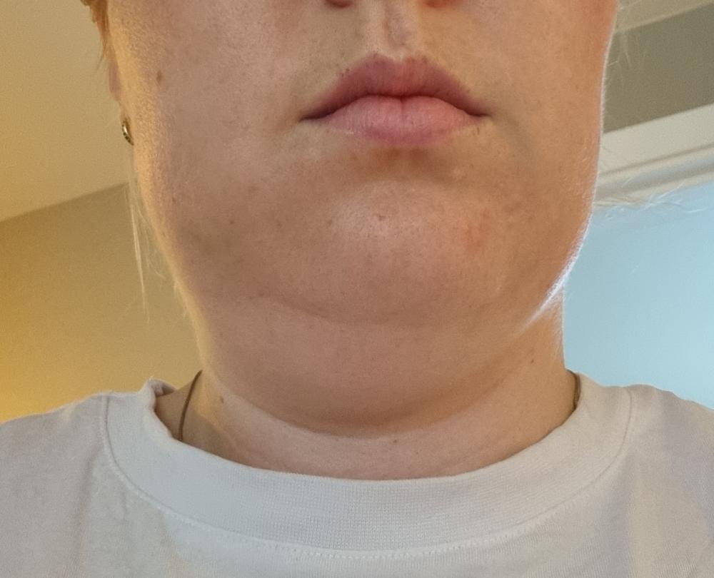 Snapchat-1245064711.thumb.jpg.7a6a7c1bb973449495f82bd1108d0cbf.jpg