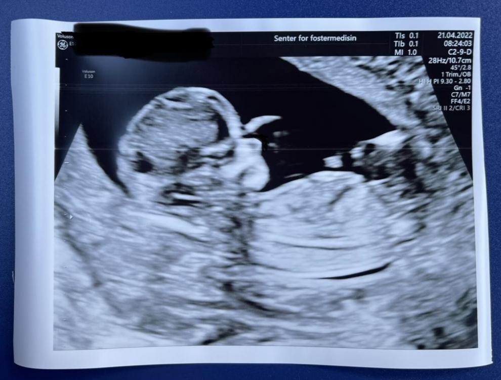 baby.jpg