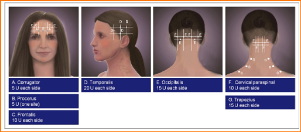 image.png.8f220bb703a1ed1c732e1f8727311469.png