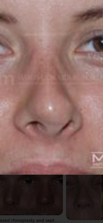 Screenshot_20220614_021127_com.android.gallery3d.jpg
