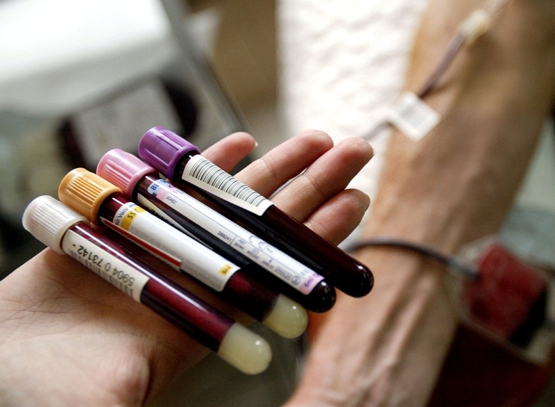 blood_bloodwork_samples_tests_patient_iv_haematology.jpg.a9c47cb1bca275f2e62de696718a491d.jpg