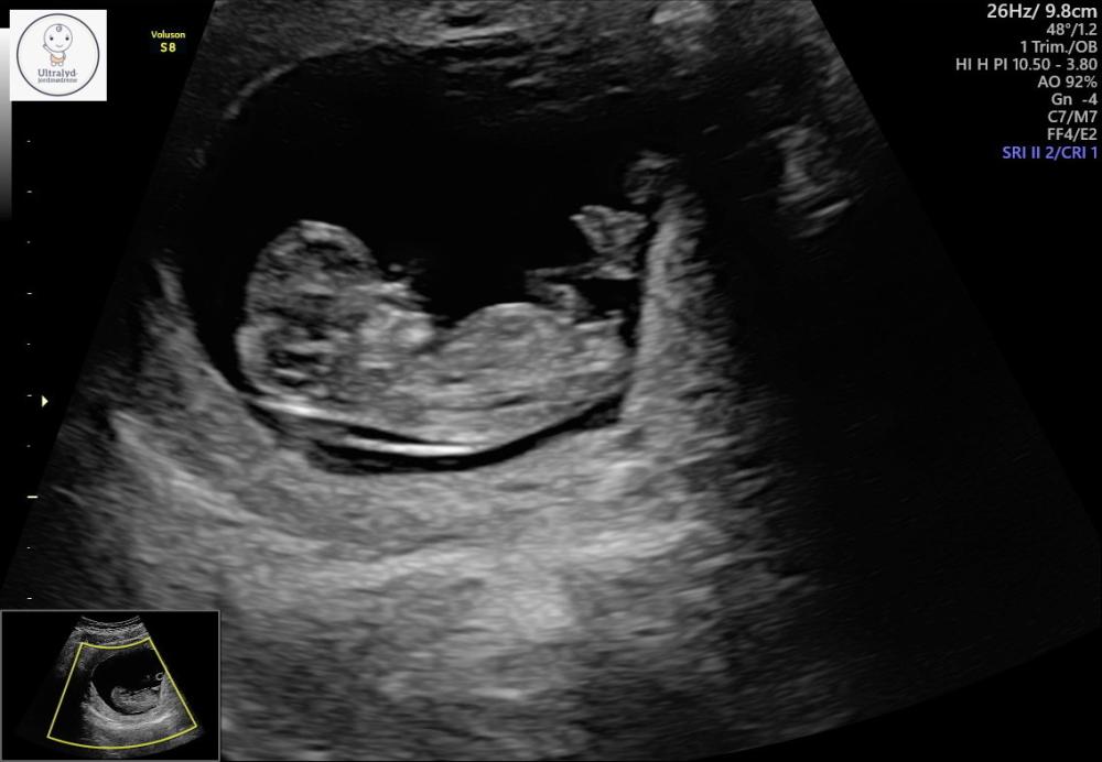 00E4D4F8-4526-42FD-AB47-980CBF0162E7.thumb.jpeg.f792023ab3638daf3ef4c84114699c73.jpeg