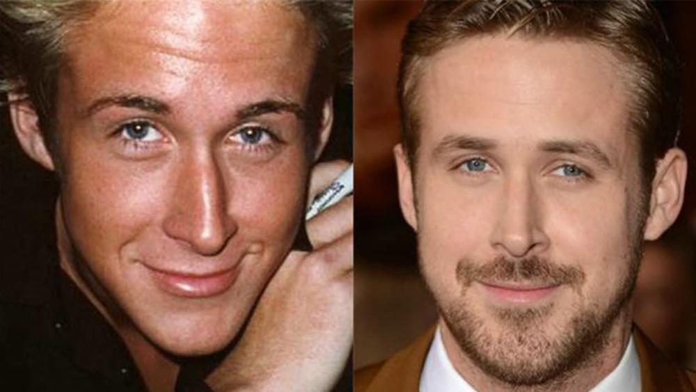 Hollywood-Men-Plastic-Surgery-Before-And-After-1.jpg