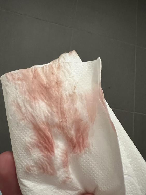 469C3017-B72C-4E36-A88B-35F33ACD096C.thumb.jpeg.be081531a1a9fd2842a6ba2b413a71e2.jpeg