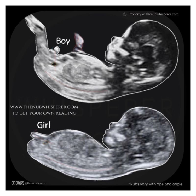 image.thumb.png.de29d8a02c443179f635b30bfbeb33d8.png