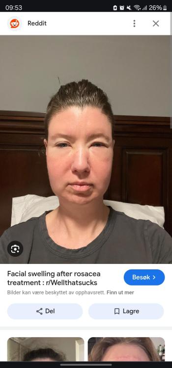 Screenshot_20240912_095318_Chrome.thumb.jpg.4de687285a2275cf5c61c23ef2e353c0.jpg