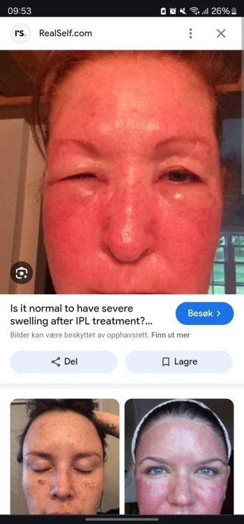 Screenshot_20240912_095326_Chrome.thumb.jpg.7e3e807b9671949521c297c923aee3cc.jpg