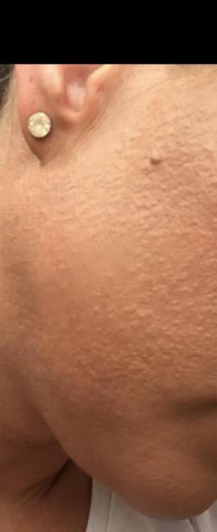 IMG_1704.thumb.jpeg.1f6d969c779a97fe945f0c471dd8c0a9.jpeg
