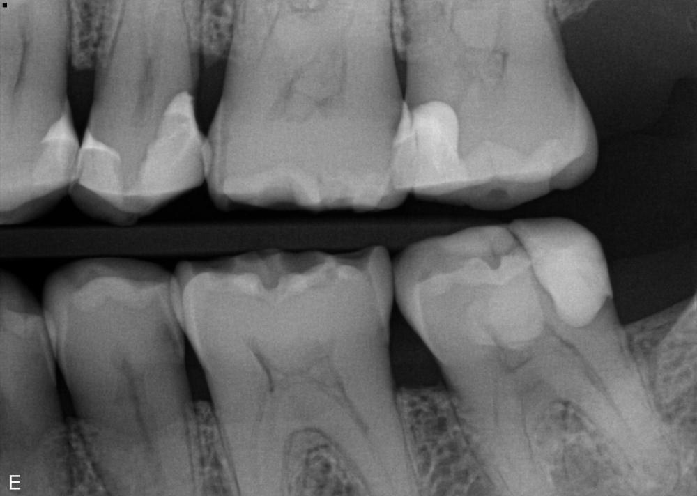 40305_Liggende Bitewing_2025-08-29_09-37-04.jpg
