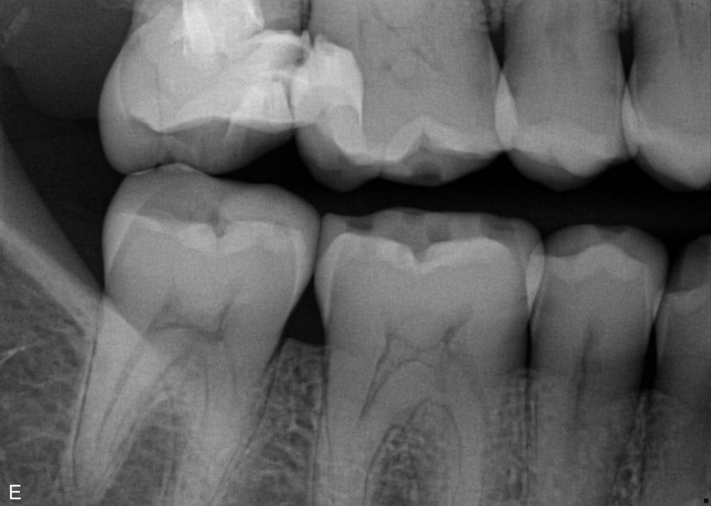 40305_Liggende Bitewing_2025-08-29_09-37-29.jpg